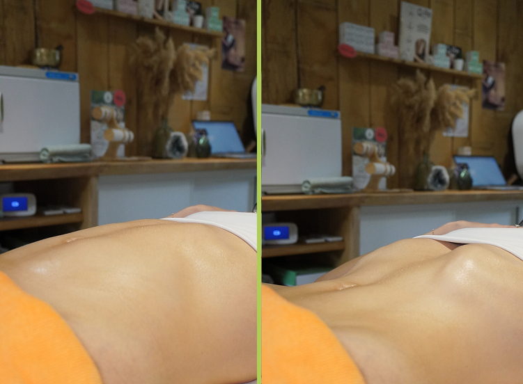 Massage Renata França